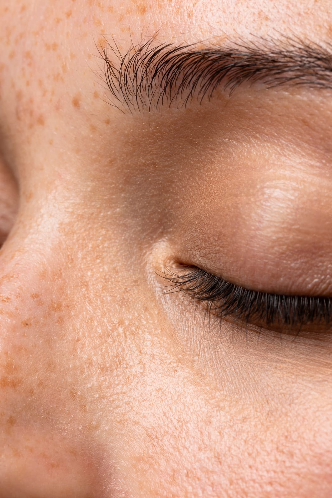 Mappatura dei Nei e Dermatologia Preventiva: La visita fondamentale per la salute cutanea
